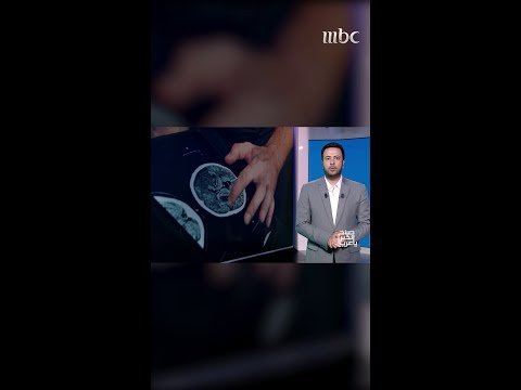 أجهزة ذكية تساعد على استعادة المشي